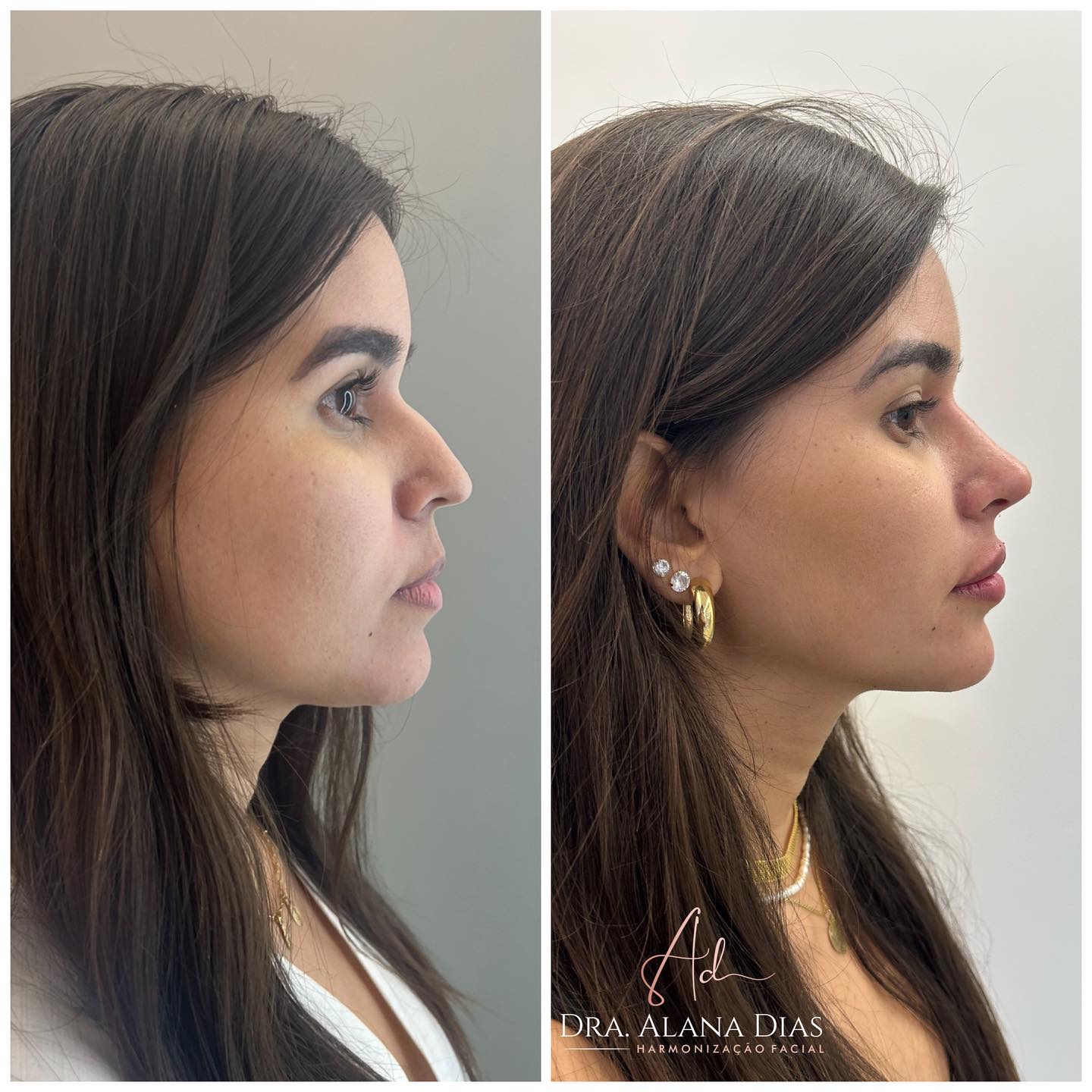Transformação Facial
